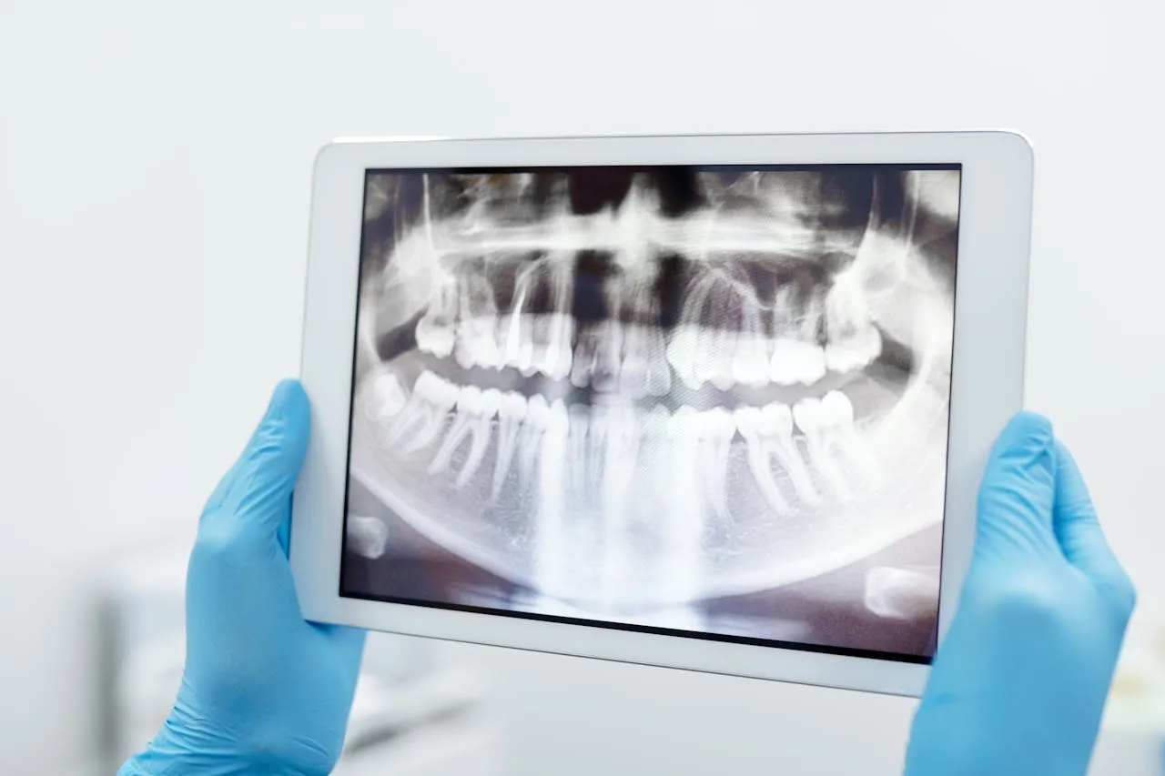 Dentist reviewing a patient's dental X-ray scan on a tablet before treatment planning — the standard diagnostic approach at top Turkish clinics