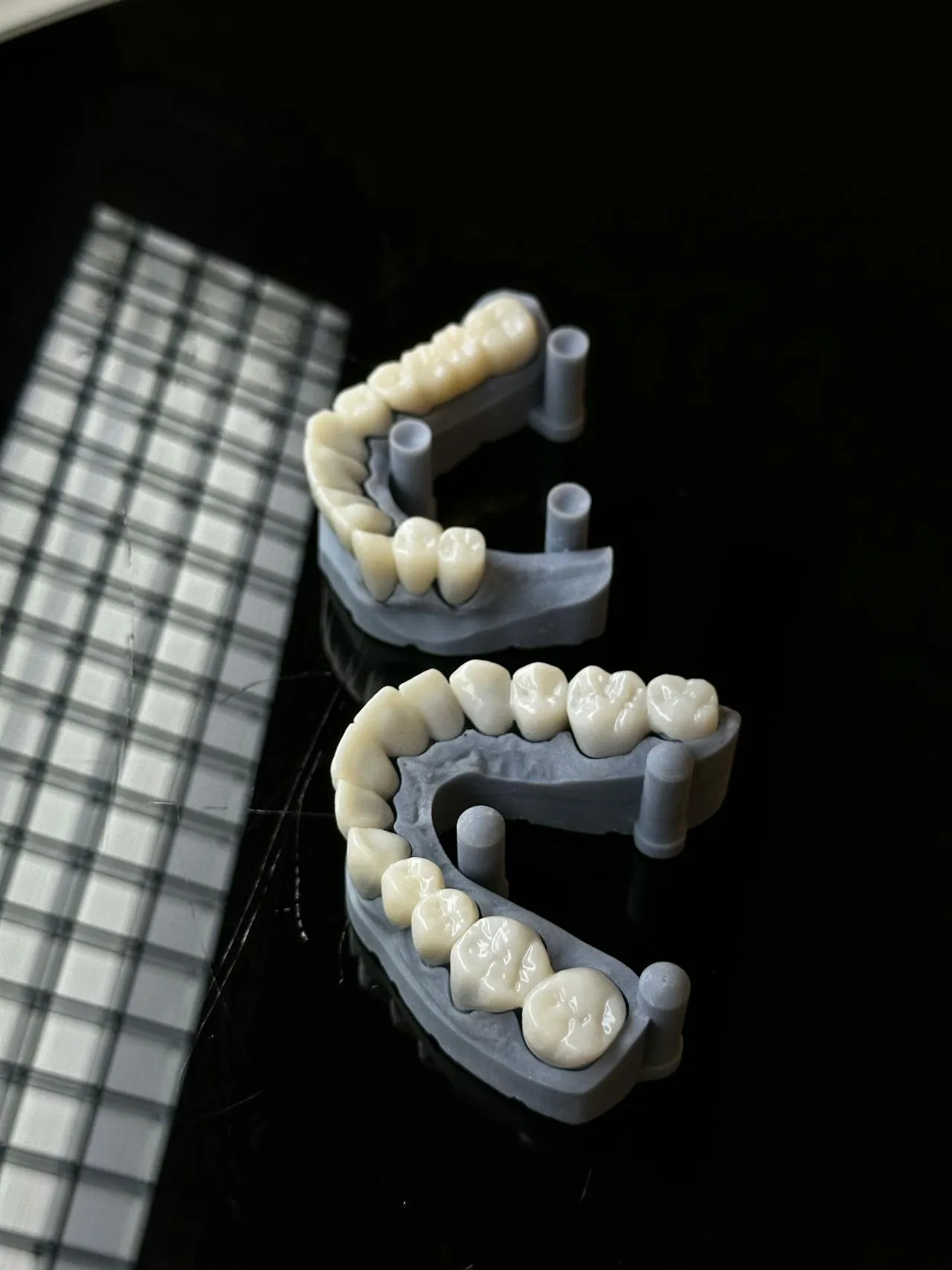 Zirconia dental crowns and implant components displayed at a professional dental laboratory — the premium ceramic material used for implant-supported crowns at top Turkish clinics
